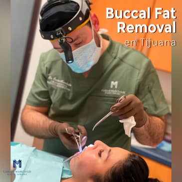 Slider image (3) Marciales Plastic Surgery